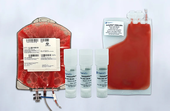 OrganaBio Expands Cell and Gene Therapy Donor Base to Include Patients with Lupus
