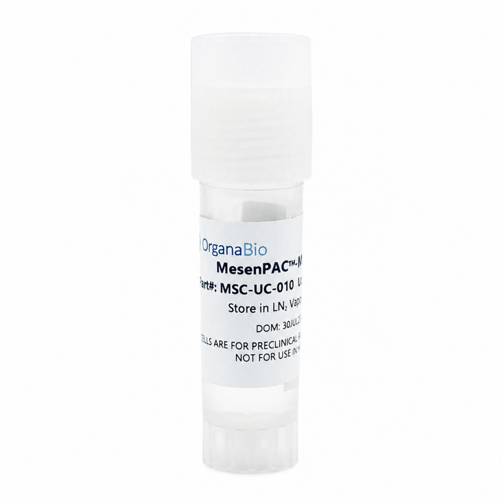 Mesenchymal Stem Cells (Umbilical Cord)
